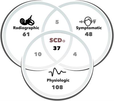 Ocular Vestibular-Evoked Myogenic Potential Amplitudes Elicited at 4 kHz Optimize Detection of Superior Semicircular Canal Dehiscence